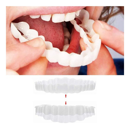 2kit Dientes Postizos Temporal De Silicona Carillas Dentales