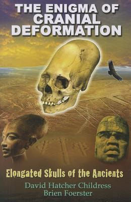 Enigma Of Cranial Deformation : Elongated Skulls Of The A...