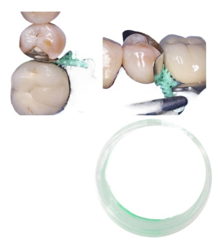 Cuña Interdental De Silicona Adaptativa Dental, Cuñas Matric