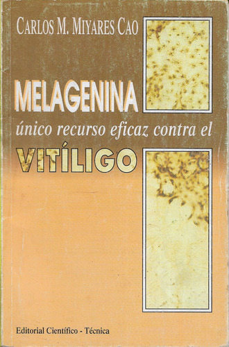 Melagenina