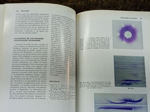 Neumologia * A. Agusti Vidal * Atlas Para El Medico * Salvat