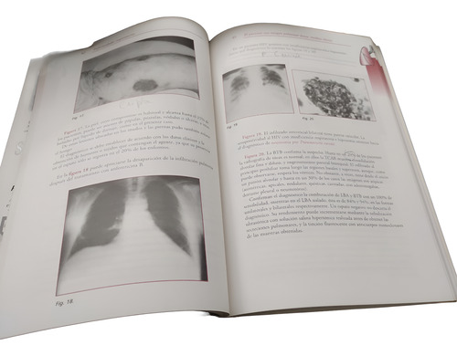 Proami - Medicina Interna Fernando Lasala Ed . Panamericana (Usado)