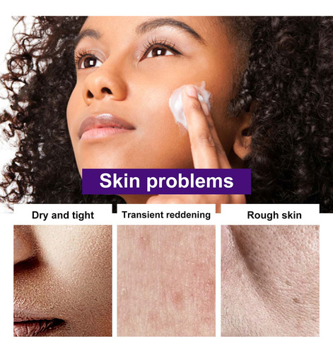 O Creme De Lifting Facial Hidrata Profundamente A Pele Seca