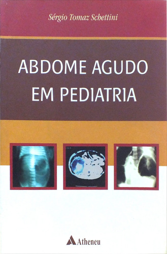 Abdome agudo em pediatria, de Schettini, Sérgio Tomaz. Editora Atheneu Ltda, capa mole em português, 2006