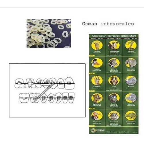 Elástico Intraoral Intermaxilares Para Brackets Ortodoncia