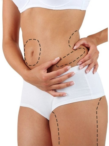 Mesoterapia Corporal Tratamiento 