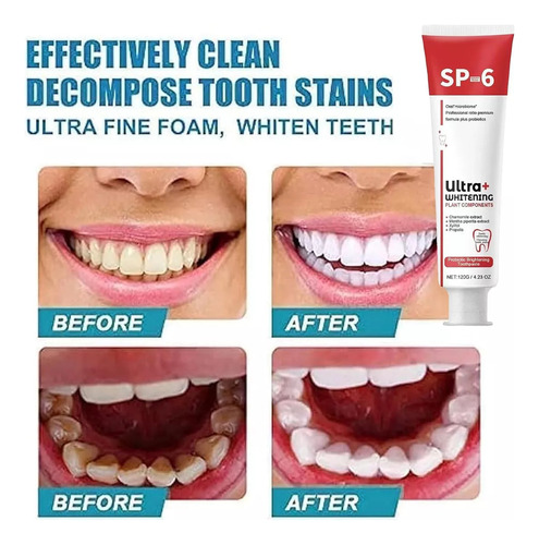 Sp-6 Ultra Whitening, Pasta De Dientes Sp 6 -0