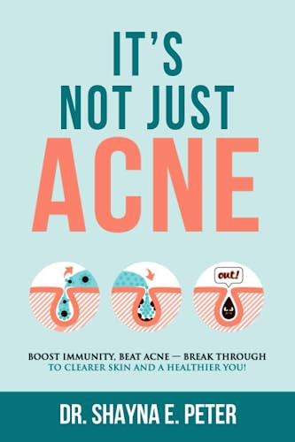 Book : Its Not Just Acne Boost Immunity, Beat Acne - Break.