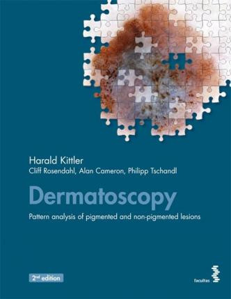 Libro Dermatoscopy : Pattern Analysis Of Pigmented And No...