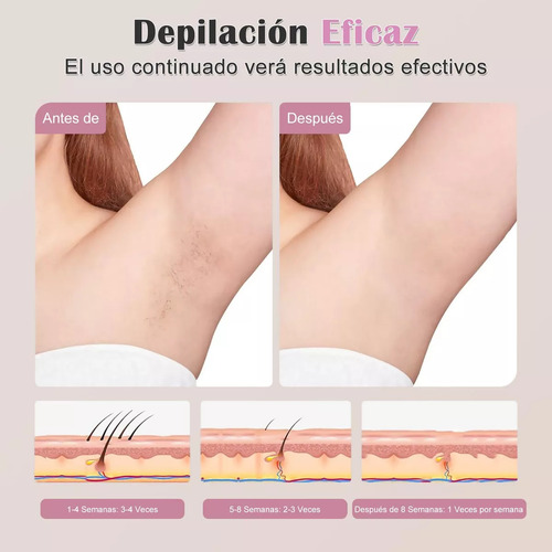 Para Depiladora Con Luz Pulsada Ipl, Depilación Flash