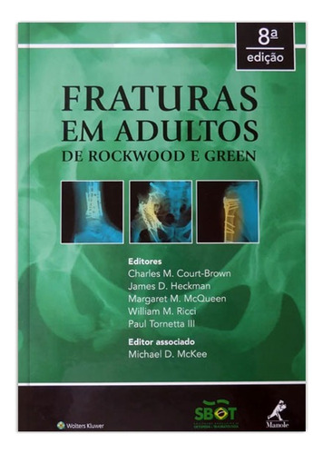 Fraturas em adultos: de Rockwood e Green, de Vários autores. Editora Manole LTDA, capa mole em português, 2016