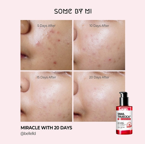 Imagen 4 de 4 de Some By Mi Snail Truecica Miracle Repair Kit Baba De Caracol