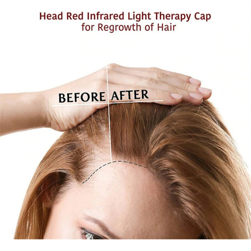 P Gorra Fisioterapia Con Instrumento Infrarrojo Para El Cre