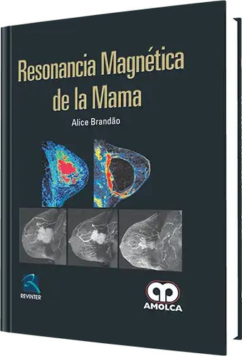 Resonancia Magnética De La Mama   Brandão