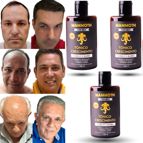 Kit Tônico Poderoso - Calvície - Alopecia - Queda/cabelo