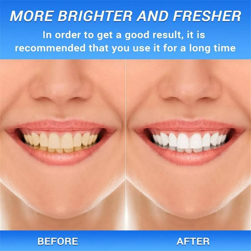 Creme Dental Body Accel, Creme Dental Clareador