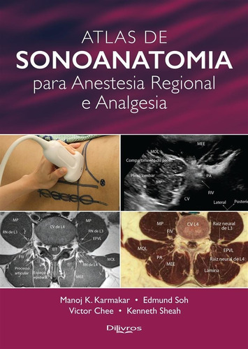 Livro: Sonoanatomia Para Anestesia Regional E Analgesia