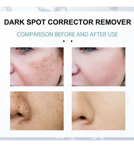 Crema Correctora E Antimanchas Para Rostro Y Cuerpo Age S