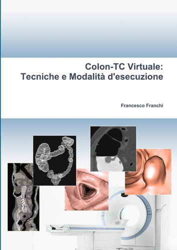 Libro: Colon-tc Virtuale: Tecniche E Modalità D Esecuzione (