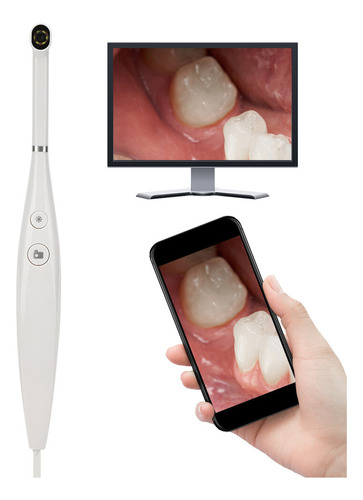 Endoscopio Dental Oral Usb, Luces Led Ajustables, Intraorale