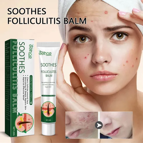 2×crema Hidratante Hidratante Para Eliminar La Foliculitis