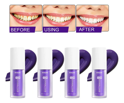 4 Unidades De Espuma De Aclaramiento Dental V34 30 Ml Fx