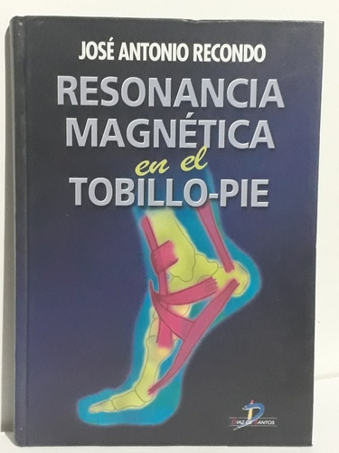 Resonancia Magnetica En El Tobillo-pie