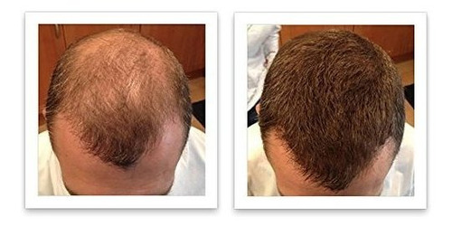 Corrector De Pérdida De Cabello Caboki - Marrón Oscuro