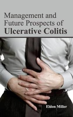 Libro Management And Future Prospects Of Ulcerative Colit...