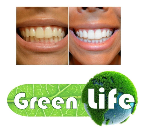 Como Blanquear Mis Dientes Como Profesional Greenlife 40gr