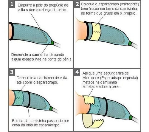 Kit Uripen Com Extensão N°5 Com 50 Unidades + Bolsa Coletora