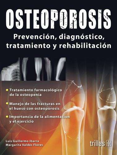 Osteoporosis - Ibarra, Valdes Flores