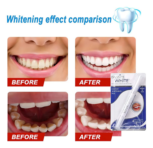 Bolígrafo Blanqueador Instantáneo Natural Dazzling White Sin Sensibilidad Advance, Bolígrafo Blanqueador De Dientes, Bolígrafo Blanco Brillante Para Iluminar Los Dientes, Blanqueador De Dientes