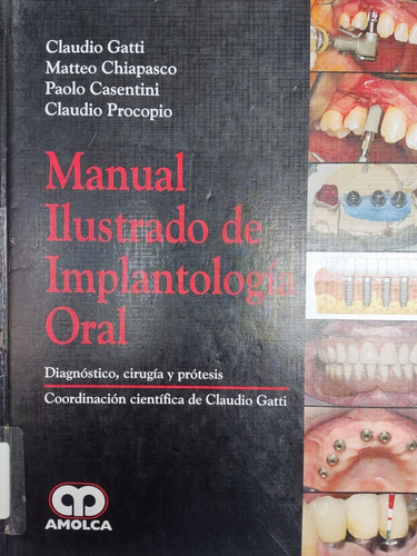 Libro Manual Ilustrado De Implantología Oral Gatti 173f8