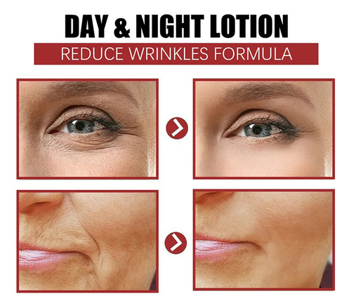 Crema De Ojos Que Elimina Bolsas De Ojos Al Instante Y Elimi