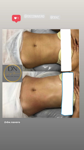 Imagem 3 de 4 de Massagens - Linfática, Massofilaxia, Modeladora.