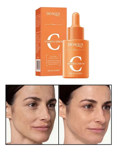 Serum Crema C Elimina Manchas Paño Pecas Aclarante Anti Edad Tipo De Piel Normal