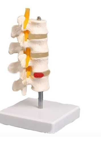 Modelo Anatómico De Lumbar Tamaño Natural 4 Vertebras