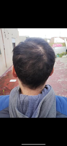 Shampoo Y Acondicionador Tratamiento Anticaida