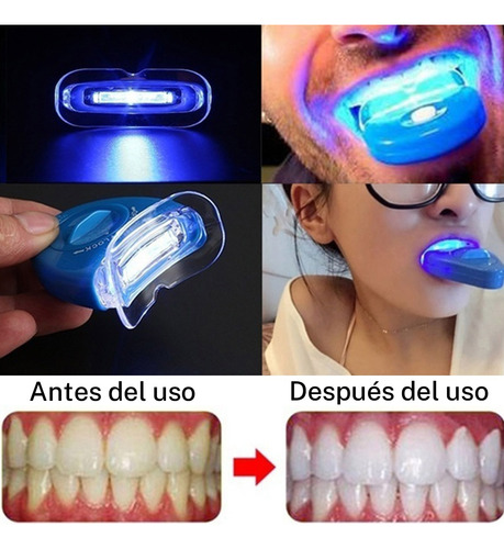 Kit De Blanquear Dientes Lampara Led Gel Dental 7 En 1