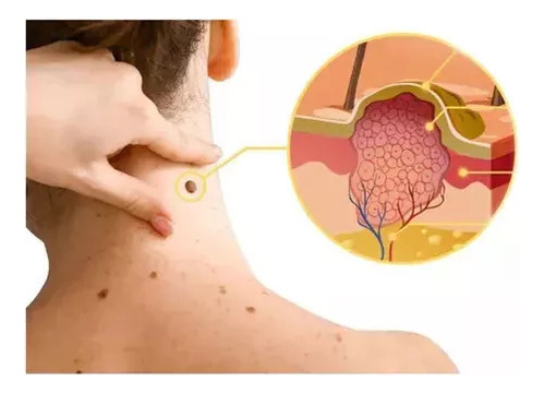 A 4pcs Tag Recede Bee,tag Recede Bee Spray Para Mujeres Y