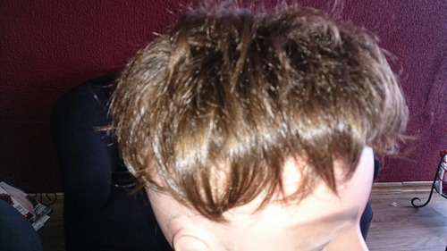 Prótese Masculina Cabelo Natural