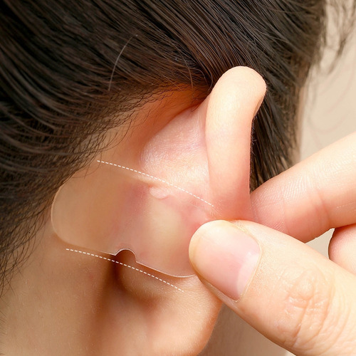 Pegatinas De Soporte Para Orejas De Elfo, Corrector De Oreja