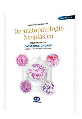 Diagnóstico Patológico Dermatopatología Neoplásica 2da Ed., De David Cassarino., Vol. 1. Editorial Amolca, Tapa Dura En Español, 2019