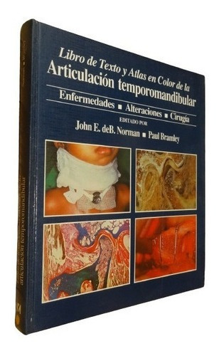 Libro De Texto Y Atlas En Color De La Articulación Tem&-.
