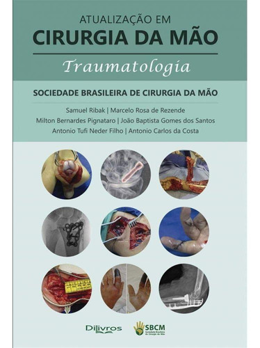 Livro: Atualizacao Em Cirurgia Da Mao Traumatologia