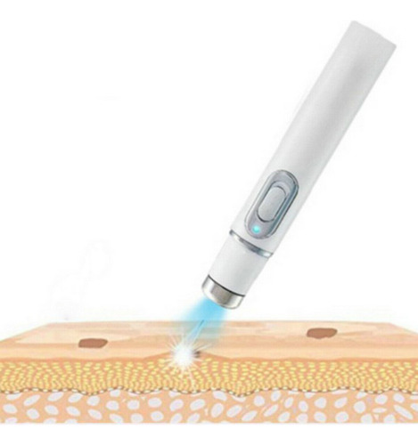 Terapia Uv Anti Acne + Bioaqua Blanqueadora Zonas Intimas