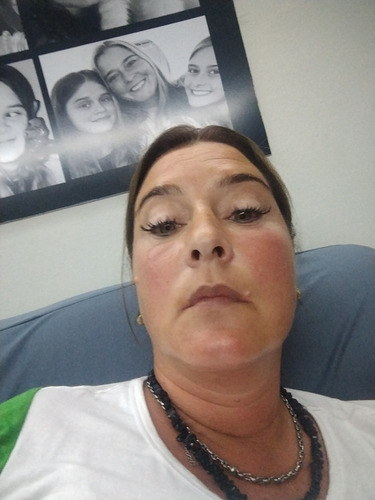 Imagen 2 de 2 de Pestañas Pelo A Pelo