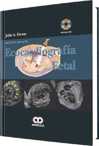 Libro - Ecocardiografía Fetal +  2ª Ed Drose Amolca