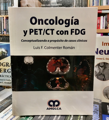 Oncología Y Pet/ct Con Fdg Concepto A Propósito De Casos Clí